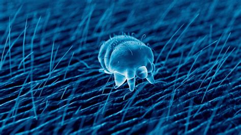 Everything You Need To Know About Scabies