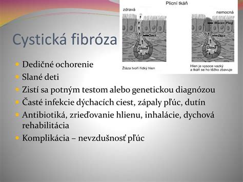 Chromozomu a je zodpovědný za stav chloridových kanálů na. PPT - Ochorenia dýchacej sústavy PowerPoint Presentation ...