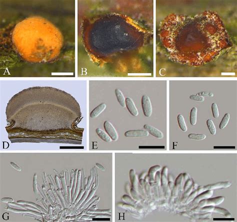 Morphology Of Nectria Ulmicola From Ulmus Davidiana Var Japonica