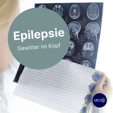 Fast Jeder Hat Schon Mal Von Epilepsie Med9 Ärztezentrum