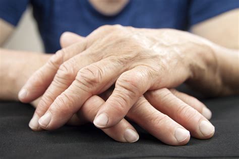 What You Need To Know About Rheumatoid Arthritis Symptoms And Treatment