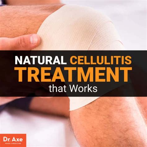 Cellulitis Behandeling Natural Remedies And Prevention Tips Home Healthcare