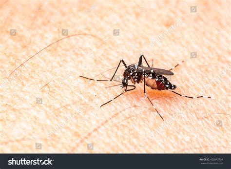 Aedes Mosquito Bite On Skin Mosquito Stock Photo Edit Now 422843794