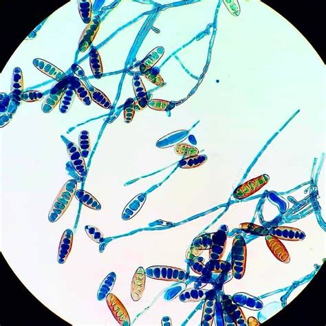 Bipolaris Spp Filamentous Dematiaceous Fungi Photo By Museudemicrobiologiaoficial