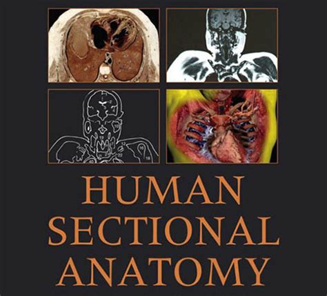 Mulți Livrare începe Cross Sectional Anatomy Book Absay Defect Noua