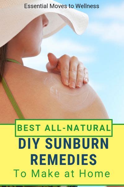 If Youre In Need Of Sunburn Relief Try Fast Effective Sunburn