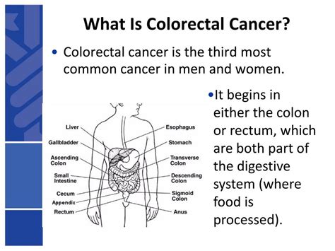 Some colors are used multiple times to represent different things. PPT - Colorectal Cancer PowerPoint Presentation, free ...