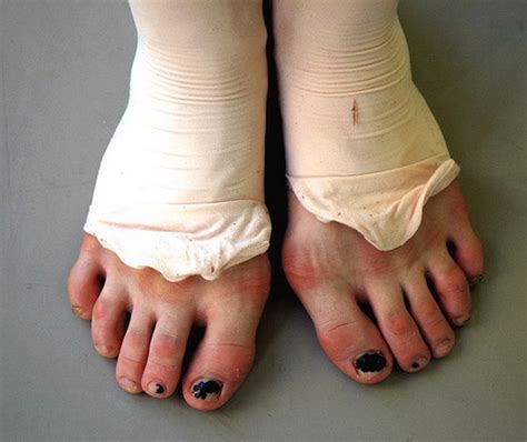 20 besten Ballet feet Bilder auf Pinterest | Ballett füße, Tanzen und