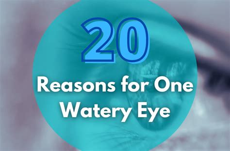 15 Reasons For One Watery Eye Allergy Preventions