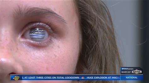 Local Girl Honors Mother With Glass Eye Design Youtube