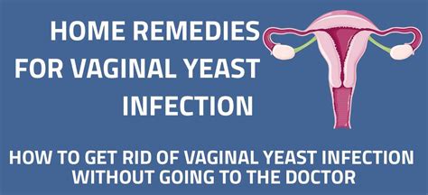 What Is Vaginal Yeast Infection Everything To Know About It Jmexclusives Hot Sex Picture