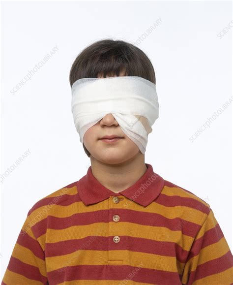 Boy With Bandages Around Eyes Stock Image C0520470 Science Photo