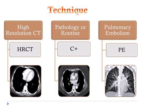 Ppt Chest Ct Powerpoint Presentation Free Download Id
