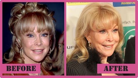 Barbara Eden Plastic Surgery Before And After Barbara Eden Plastic
