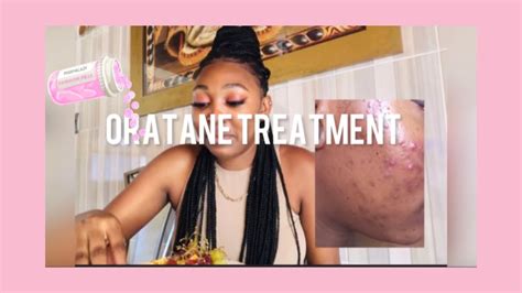 My Oratane Journey How I Cleared My Acne Side Effects Clear Skin South African YouTuber