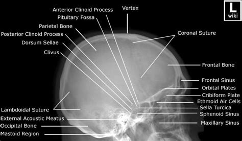 Radiographic Anatomy Skull Lateral X Ray Anatomypositions