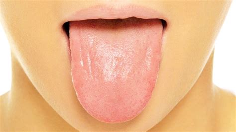 How Your Tongue Looks Like Has Something To Tell About Your Health