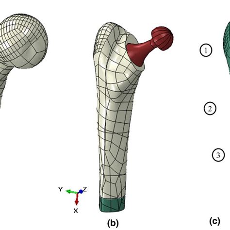 Three Dimensional Models Of The A Intact Femur B Thp And C Gruen