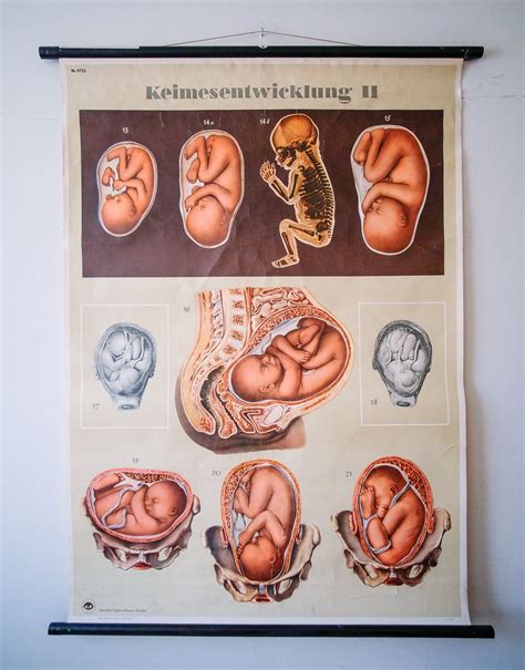 Original Anatomical Vintage German Educational School Wall Chart