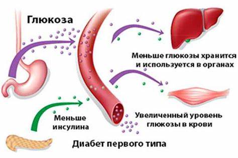 Какое диета сахарный диабет