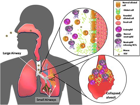 Frontiers Host Components Contributing To Respiratory Syncytial Virus