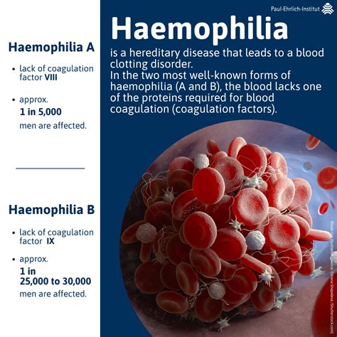 News World Haemophilia Day Treatment Options For Haemophilia Paul