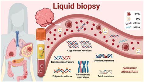 Biomedicines Free Full Text Clinical Utility Of Liquid Biopsy Based
