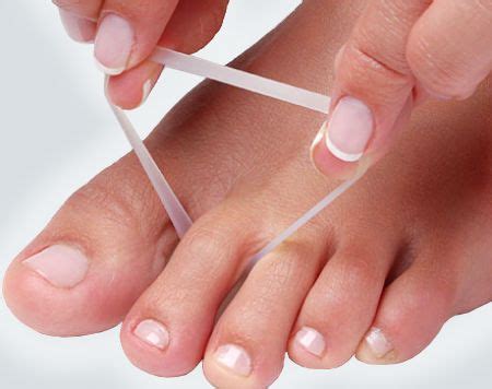 How Are Hammertoes Treated Often The First Step In Treating