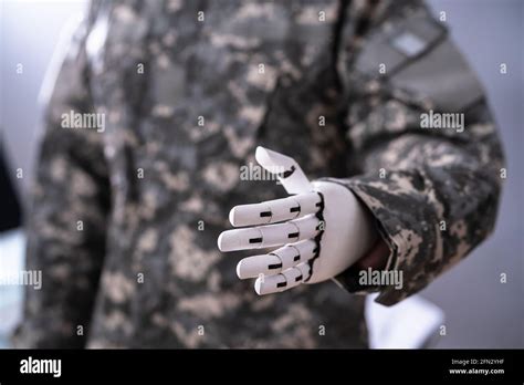 Soldier Artificial Prosthetic Limb Hand War Veteran Stock Photo Alamy