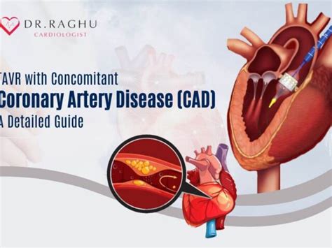 Diagnosing Congestive Heart Failure Dr Raghu Cardiologist