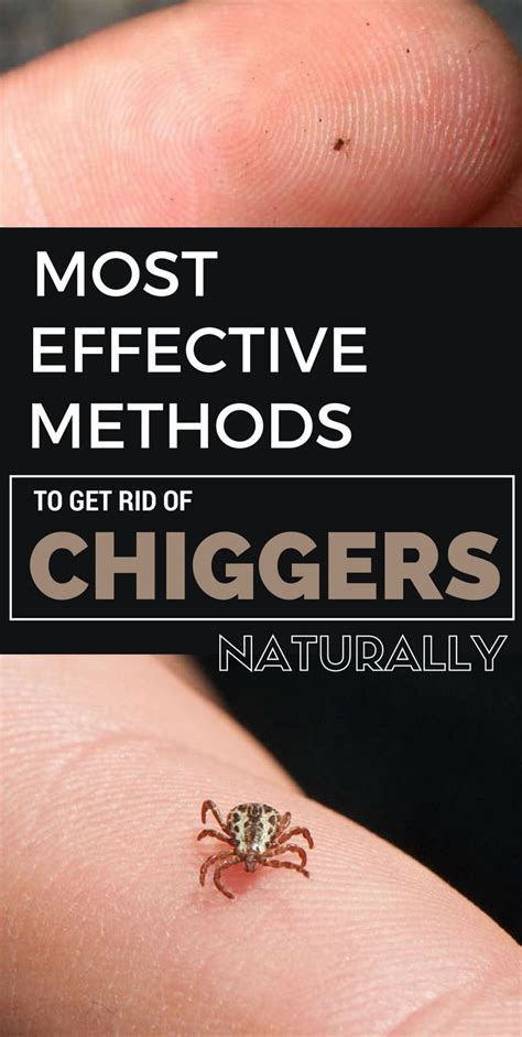 Chigger Pictures On Skin 5 Signs And Symptoms Of Chiggers Bites And How