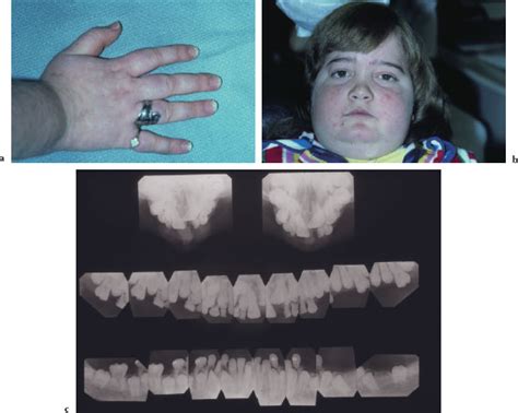 4 Examination Of The Head And Neck Pocket Dentistry