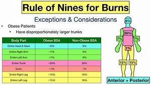 Rule Of Nines Burn Chart Printable