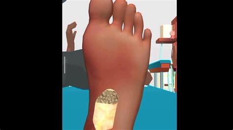 asmr foot treatment game youtube