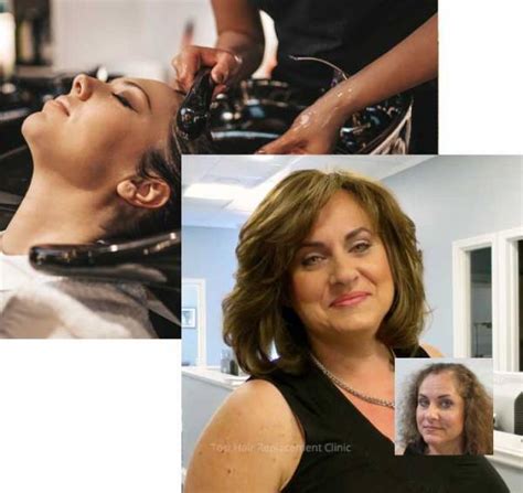 women s hair loss solutions exeter scranton pennsylvania