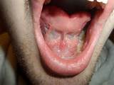 Photos of Home Remedies Salty Taste In Mouth