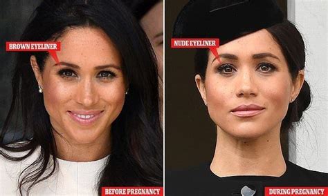 Meghan Markle Plastic Surgery Nose Job Teeth Before And After