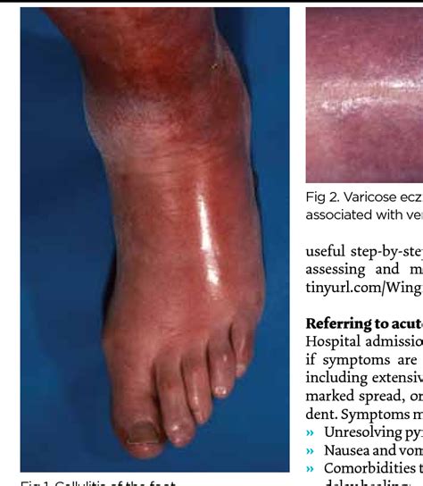 Figure 1 From Diagnosing Assessing And Treating Cellulitis The