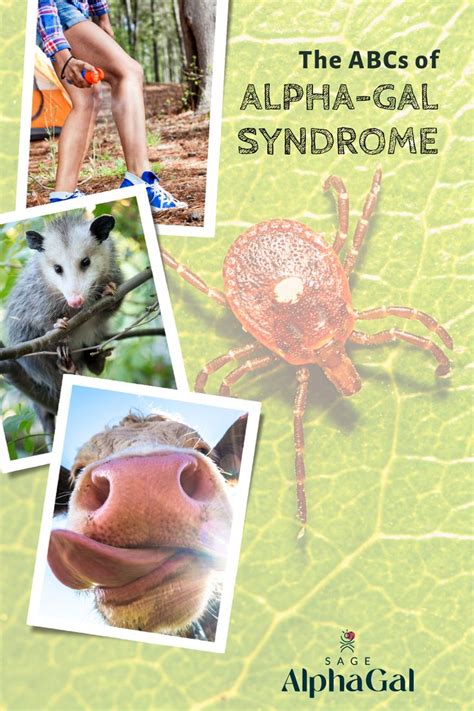 What Is Alpha Gal Syndrome The Abcs Of Ags Alpha Gal Mammals