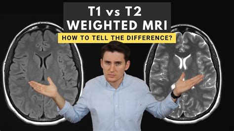 What Is The Difference Between T1 And T2 Imaging In Mri