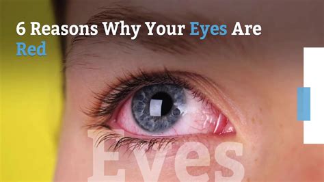 What Causes Red Itchy Burning Eyes