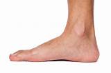 Images of Flat Feet