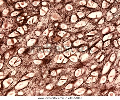 Light Micrograph Elastic Cartilage Human Epiglottis Stock Photo