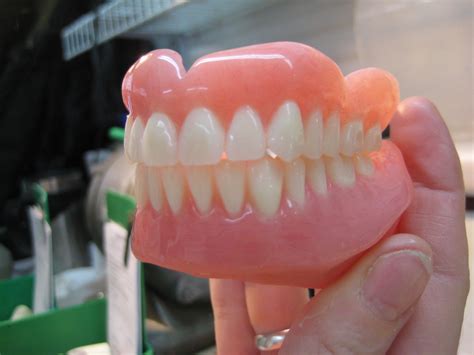Comment Nettoyer Un Dentier Tres Sale - Un frère est un ami donné par la nature.: La fabrication d'un dentier