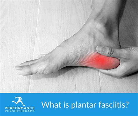 What Is Plantar Fasciitis Physiotherapy Jersey