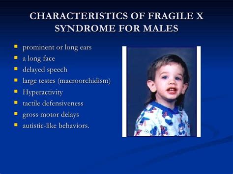 Geneticsbirth Defects As Related To Fragile X Syndrome Pictures