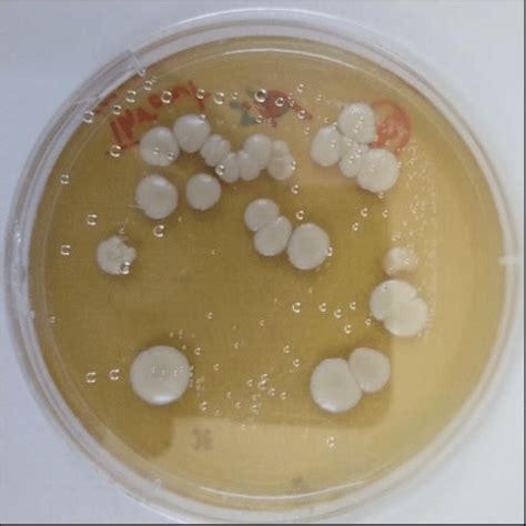 Candida Sp Growth On Sda At 37 For 24 H Download Scientific Diagram