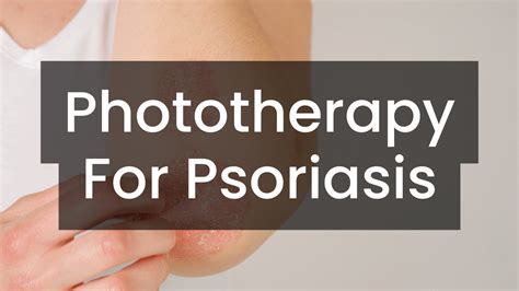 Phototherapy For Psoriasis Care Lamps