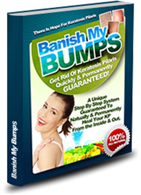 Keratosis pilaris (kp) is a skin condition in which white bumps appear on the upper arms, thighs, face and cheeks. Keratosis Pilaris Treatment | How "Banish My Bumps" Helps ...