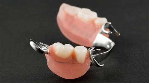 Partial Dentures For Upper Back Teeth Cost Teethwalls